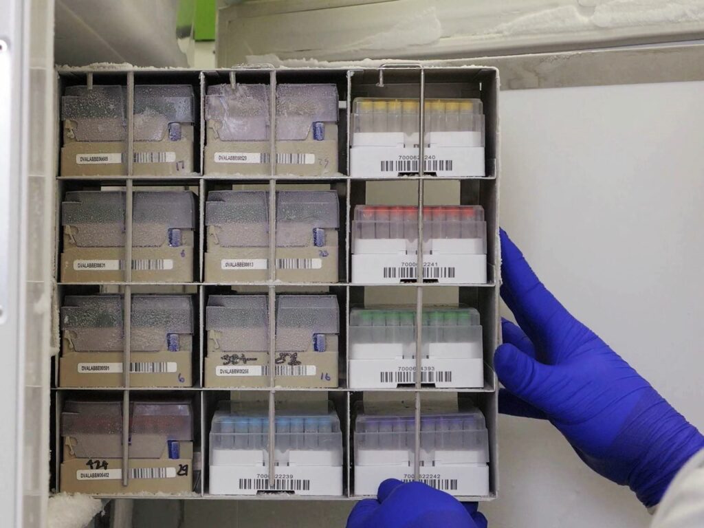 lab freezer in sampled biobank