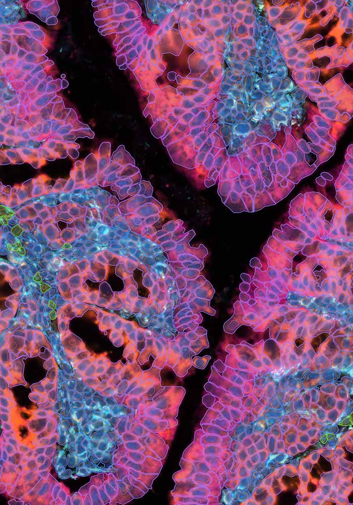 mColon FF focused segmentation sh scaled v2